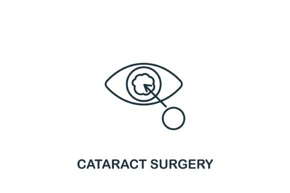 A Review of the Cataract Surgery Icon for Editorial Use